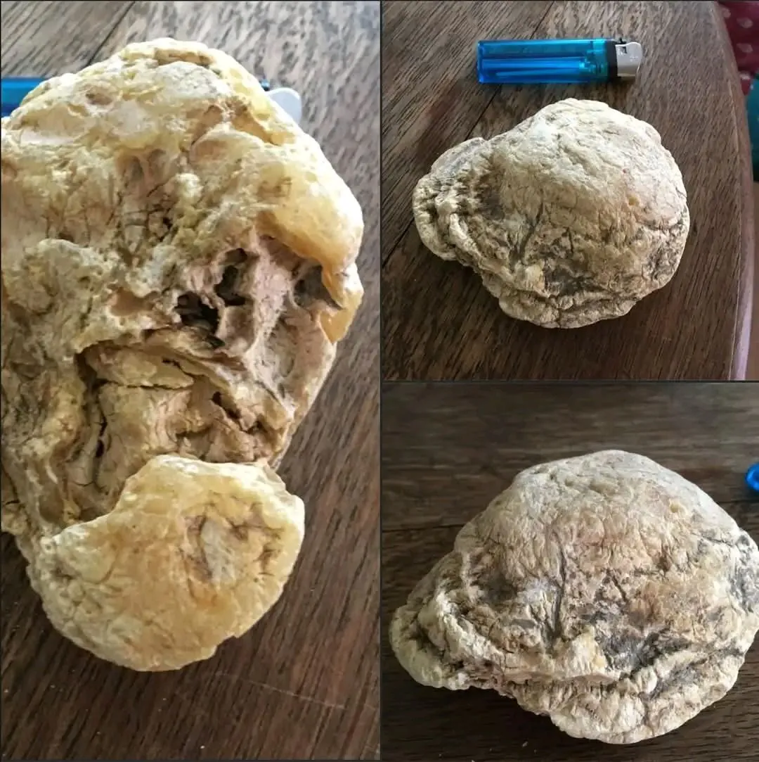 From the Ocean to Fortune: Could This Be the World’s Most Expensive Beach Find?