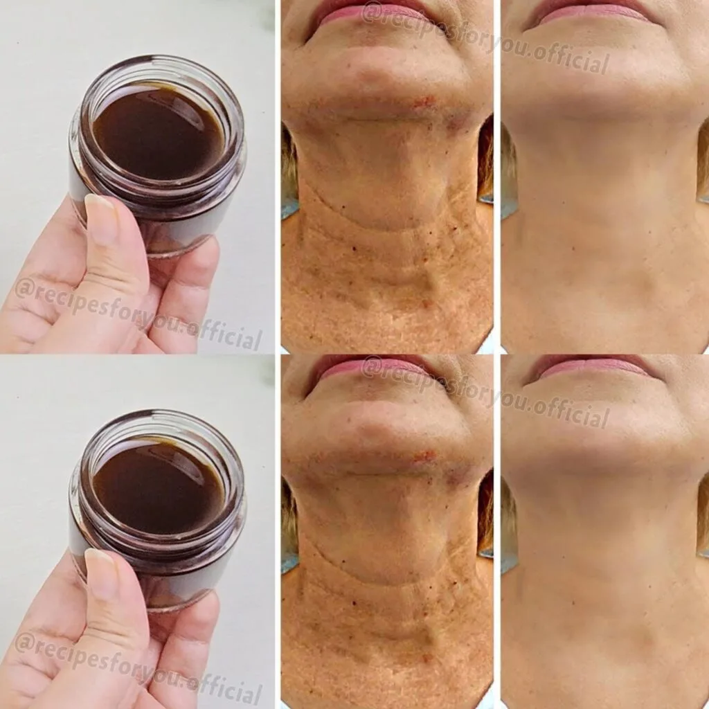 Natural Collagen Facelift! Wrinkles Will Disappear Fast! (Baking Soda and Water Skin Care)
