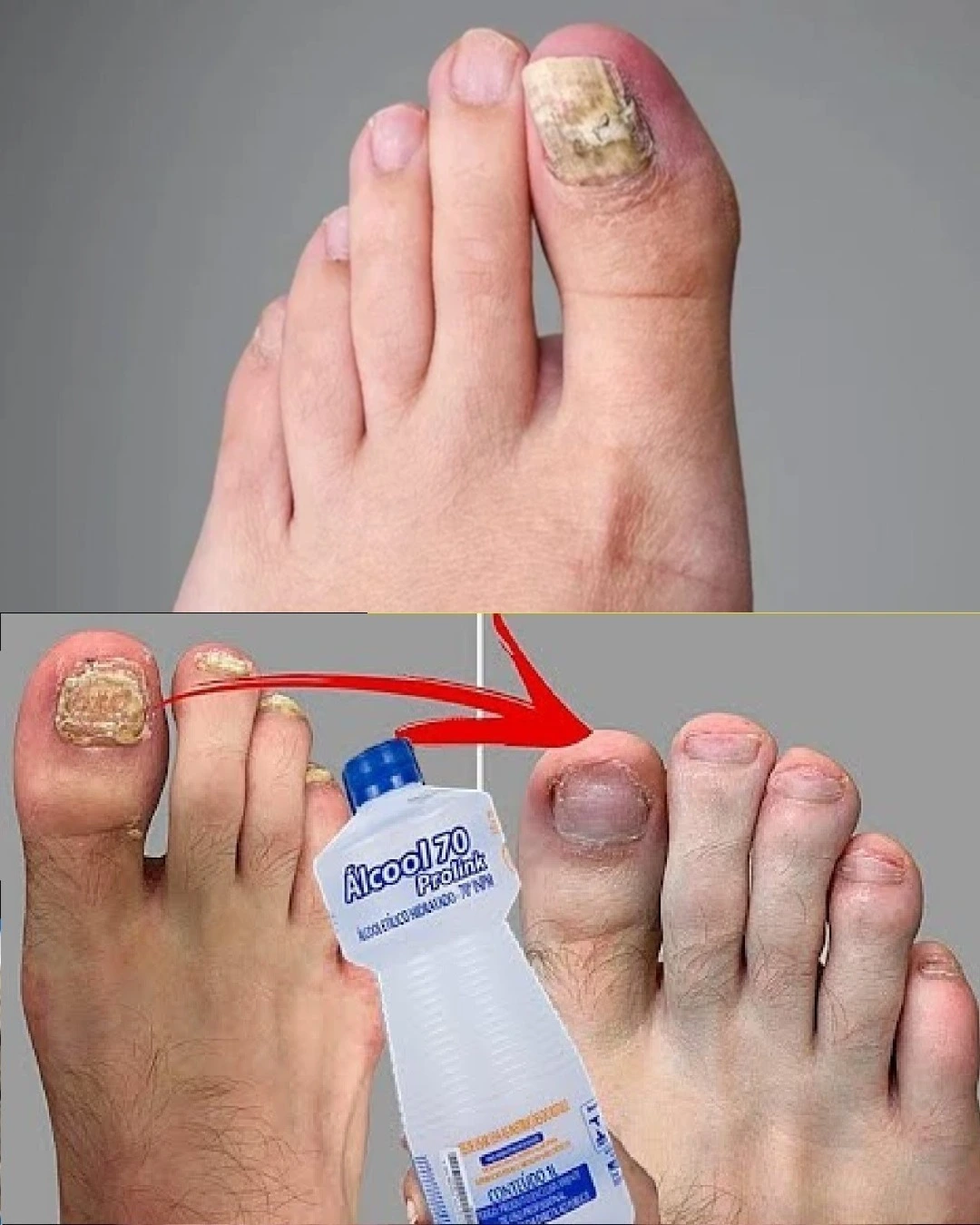 Drip and sleep! I learned this in line at the SUS (National Health Service), suffering for 20 years with my rotten nail.