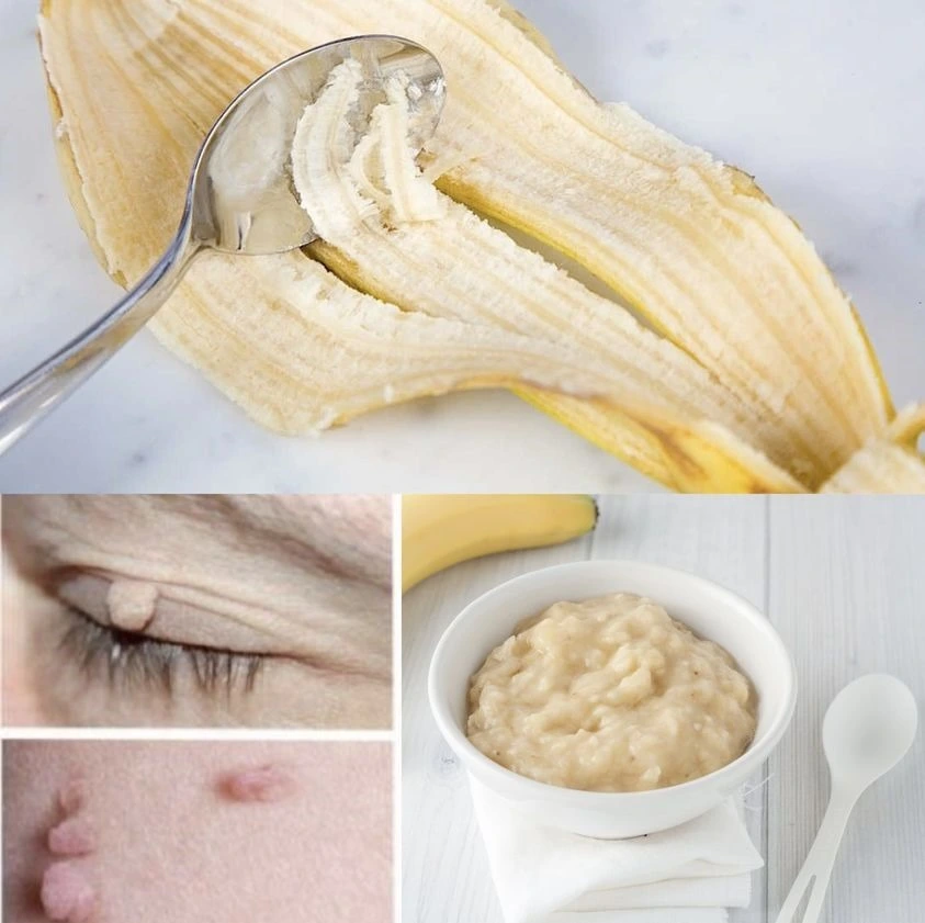Unlock the Ancient Beauty Secret: How Banana Peels Can Give You Timeless Skin